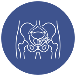 Prostatic Artery Embolisation (PAE)