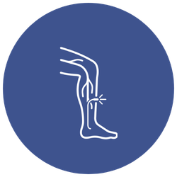 Endovenous Laser Ablation (EVLA) for Varicose Veins