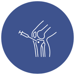 Genicular Nerve Block (Under USG Guidance)