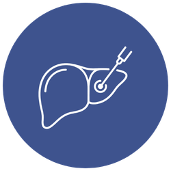Liver Interventions